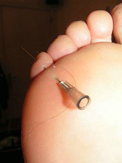 Bizarre BDSM pain: female feet are pierced with huge needles